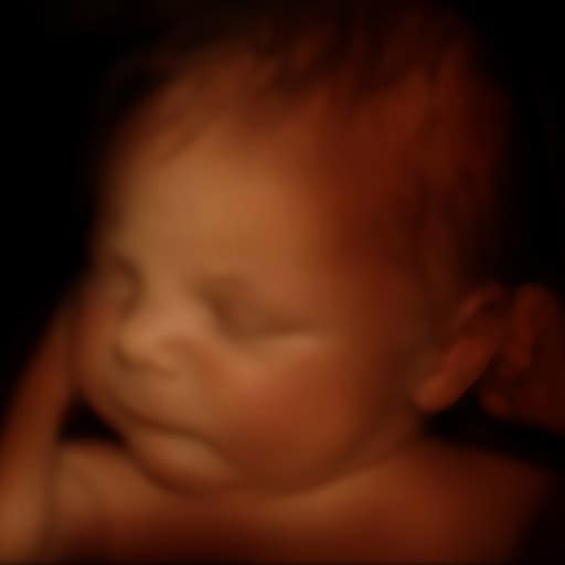 4D ultrasound photo of an infant in the womb